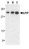STE20 Related Adaptor Beta antibody, LS-C343, Lifespan Biosciences, Western Blot image 