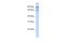 Mitogen-Activated Protein Kinase Kinase Kinase Kinase 2 antibody, A09319, Boster Biological Technology, Western Blot image 