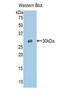 Tyrosinase antibody, LS-C296897, Lifespan Biosciences, Western Blot image 