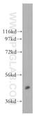 Calcium/Calmodulin Dependent Protein Kinase II Alpha antibody, 13730-1-AP, Proteintech Group, Western Blot image 