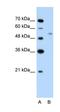 Ubiquitin Protein Ligase E3 Component N-Recognin 7 (Putative) antibody, orb325066, Biorbyt, Western Blot image 