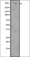 Serpin Family A Member 2 (Gene/Pseudogene) antibody, orb336598, Biorbyt, Western Blot image 