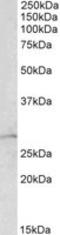 Rho GDP Dissociation Inhibitor Alpha antibody, LS-C139612, Lifespan Biosciences, Western Blot image 