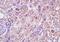 Arginase 2 antibody, orb155720, Biorbyt, Immunohistochemistry paraffin image 