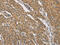 DCTN1 antibody, CSB-PA038642, Cusabio, Immunohistochemistry paraffin image 