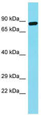 Fibronectin Type III Domain Containing 7 antibody, TA337313, Origene, Western Blot image 