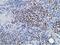 Homeobox C11 antibody, LS-C172754, Lifespan Biosciences, Immunohistochemistry paraffin image 