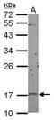Cyclin Dependent Kinase Inhibitor 2D antibody, NBP2-19651, Novus Biologicals, Western Blot image 