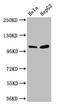 Catenin Alpha 1 antibody, LS-C375544, Lifespan Biosciences, Western Blot image 