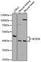 Branched Chain Keto Acid Dehydrogenase Kinase antibody, A8184, ABclonal Technology, Western Blot image 