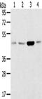 Sorting Nexin 5 antibody, CSB-PA045108, Cusabio, Western Blot image 