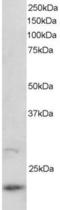 ADP Ribosylation Factor Like GTPase 2 antibody, EB05545, Everest Biotech, Western Blot image 