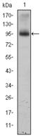 Eukaryotic Translation Elongation Factor 2 antibody, STJ98011, St John