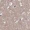 VPS37B Subunit Of ESCRT-I antibody, PA5-58299, Invitrogen Antibodies, Immunohistochemistry paraffin image 