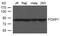 Forkhead Box P1 antibody, GTX50818, GeneTex, Western Blot image 