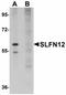 Schlafen Family Member 12 antibody, orb89927, Biorbyt, Western Blot image 