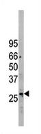 Eukaryotic Translation Initiation Factor 2B Subunit Gamma antibody, AP11734PU-N, Origene, Western Blot image 