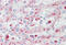 Carcinoembryonic Antigen Related Cell Adhesion Molecule 3 antibody, MBS245382, MyBioSource, Immunohistochemistry frozen image 