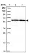Zinc Finger Protein 480 antibody, PA5-59919, Invitrogen Antibodies, Western Blot image 