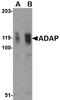 FYN Binding Protein 1 antibody, LS-C34722, Lifespan Biosciences, Western Blot image 