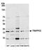 Trafficking Protein Particle Complex 5 antibody, A305-807A-M, Bethyl Labs, Western Blot image 