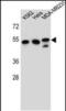 Tubulin Beta 6 Class V antibody, PA5-48312, Invitrogen Antibodies, Western Blot image 