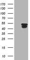 Keratin 31 antibody, CF811097, Origene, Western Blot image 