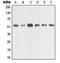 Matrix Metallopeptidase 1 antibody, MBS821671, MyBioSource, Western Blot image 