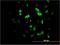 Forkhead Box A2 antibody, H00003170-M10, Novus Biologicals, Immunocytochemistry image 