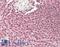 CD180 antigen antibody, LS-B13462, Lifespan Biosciences, Immunohistochemistry paraffin image 