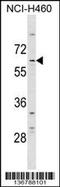 Decapping MRNA 1A antibody, 59-022, ProSci, Western Blot image 