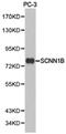 ENaC-Beta antibody, PA5-76060, Invitrogen Antibodies, Western Blot image 
