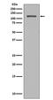 Nucleoporin 98 antibody, M01301, Boster Biological Technology, Western Blot image 