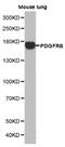 Platelet Derived Growth Factor Receptor Beta antibody, LS-C193094, Lifespan Biosciences, Western Blot image 