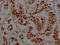 RB Binding Protein 4, Chromatin Remodeling Factor antibody, CSB-RA915915A0HU, Cusabio, Immunohistochemistry paraffin image 