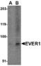 Transmembrane Channel Like 6 antibody, A07322, Boster Biological Technology, Western Blot image 