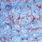 Intercellular Adhesion Molecule 1 antibody, AF583, R&D Systems, Immunohistochemistry paraffin image 