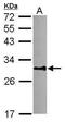 Dynein Axonemal Light Intermediate Chain 1 antibody, PA5-30643, Invitrogen Antibodies, Western Blot image 