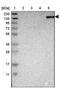TAO Kinase 2 antibody, NBP1-81465, Novus Biologicals, Western Blot image 