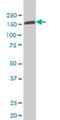 Tyrosine Kinase 2 antibody, H00007297-M03, Novus Biologicals, Western Blot image 