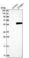 Dystrobrevin Binding Protein 1 antibody, NBP1-85300, Novus Biologicals, Western Blot image 