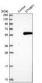 Dysbindin-1 antibody, NBP1-85300, Novus Biologicals, Western Blot image 