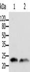 ADP Ribosylation Factor 1 antibody, TA323132, Origene, Western Blot image 