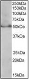 Peroxisome Proliferator Activated Receptor Delta antibody, AP23032PU-N, Origene, Western Blot image 