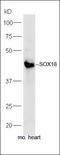 SRY-Box 18 antibody, orb186029, Biorbyt, Western Blot image 