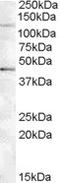 Tankyrase 2 antibody, TA305844, Origene, Western Blot image 
