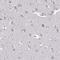 Heparan sulfate 2-O-sulfotransferase 1 antibody, HPA043069, Atlas Antibodies, Immunohistochemistry paraffin image 