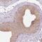 Vacuolar Protein Sorting 25 Homolog antibody, NBP2-33641, Novus Biologicals, Immunohistochemistry paraffin image 