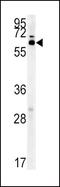 IKAROS Family Zinc Finger 3 antibody, PA5-25564, Invitrogen Antibodies, Western Blot image 