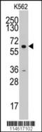 Cyclin A2 antibody, MBS9203587, MyBioSource, Western Blot image 